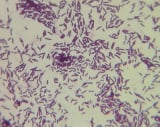 Lactobacillus Reuteri & Bifidobacterium Lactis
